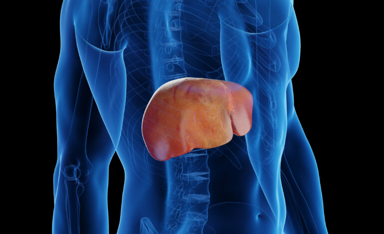 Fatty Liver: Understanding, Preventing, and Treating One of the Fastest Growing Health Concerns