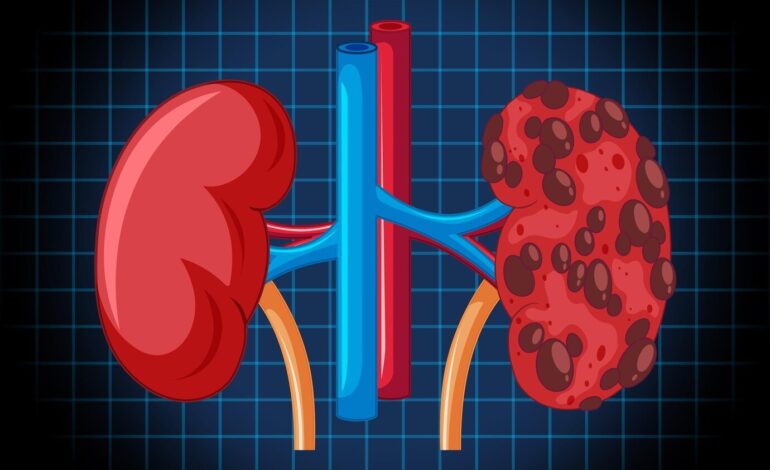 The Rock Inside You: What Kidney Stones Can Teach Us About Pain, Prevention, and Paying Attention