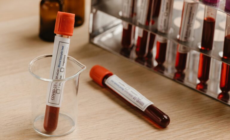 Amazon’s At-Home Blood Test Launches — But Not Where You Think