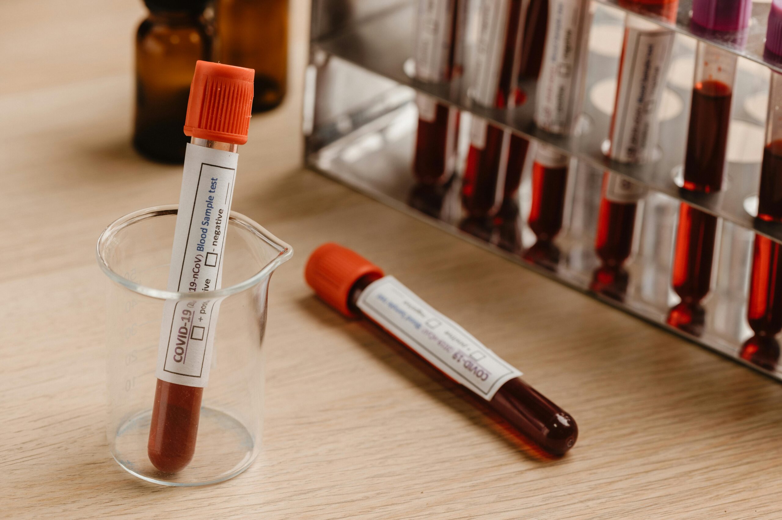 Amazon’s At-Home Blood Test Launches — But Not Where You Think