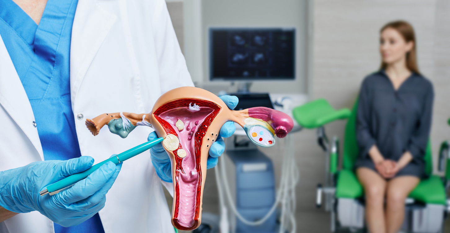 Understanding Fibroids: The Common Condition No One Talks About—But Should