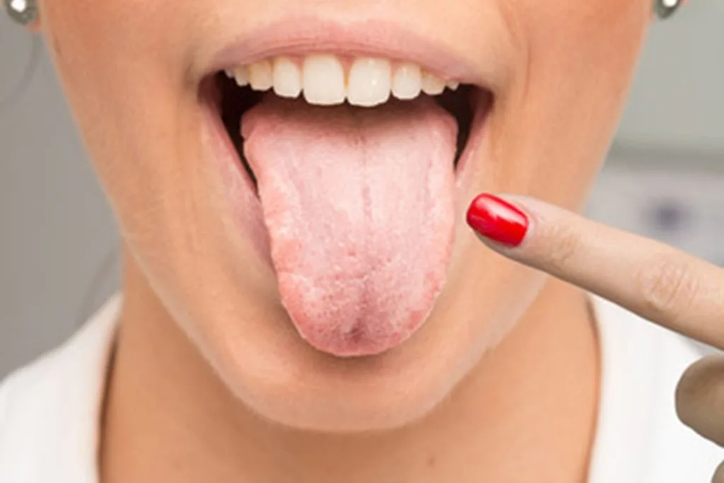 The Mouth’s Secret Universe: What the Salivary & Pharyngeal Microbiome Reveal About Health
