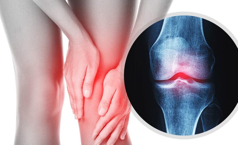 Osteoporosis in Women: My Wake-Up Call and What Every Woman Should Know