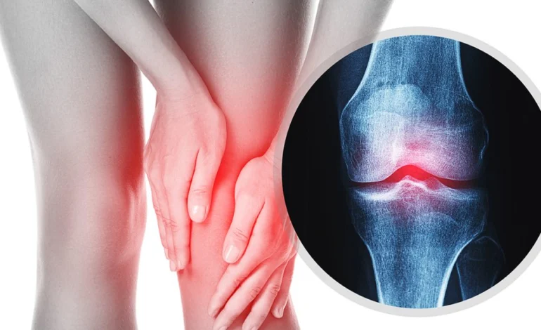 Osteoporosis in Women: My Wake-Up Call and What Every Woman Should Know