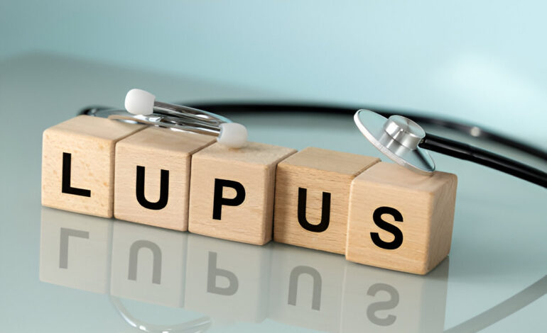 Lupus: What It Is and How It Affects People