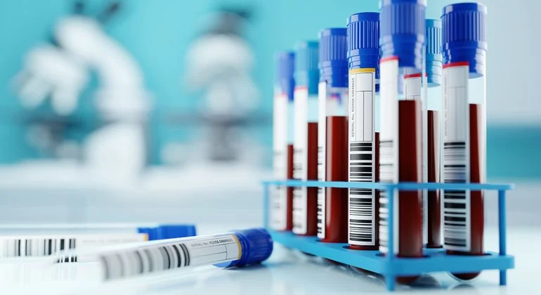 I Took Labcorp’s 1,000 Biomarker Test—Here’s What I Learned (and What I Wish Was Different)