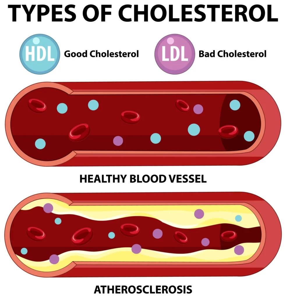 natural ways to lower cholesterol
