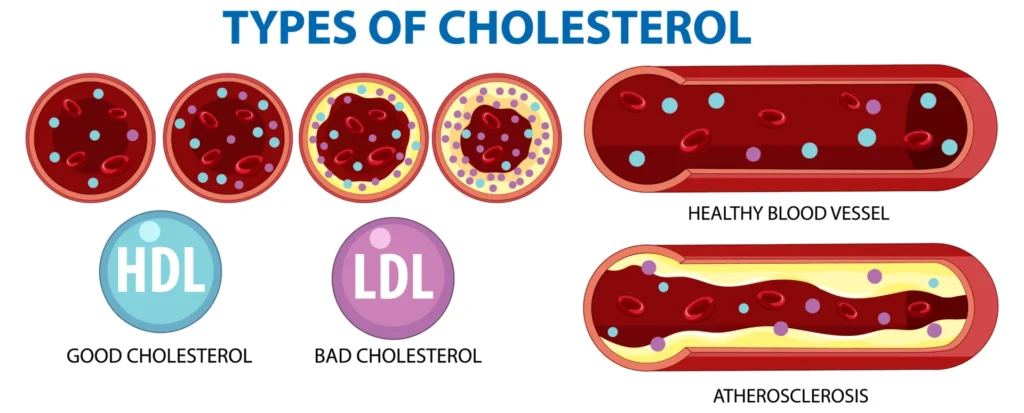 Saturated Fat and Cholesterol